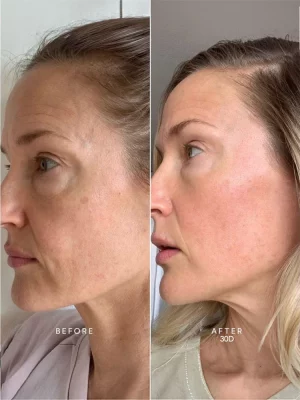 Caviar Lifting Serum z kwasem hialuronowym i majestem 30 ml 2
