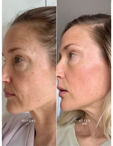 Caviar Lifting Serum with hyaluronic acid and majestem 30 ml